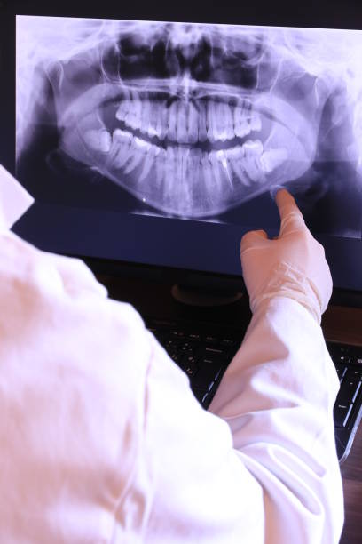 Best Emergency Treatment for Toothache in Hartselle, AL