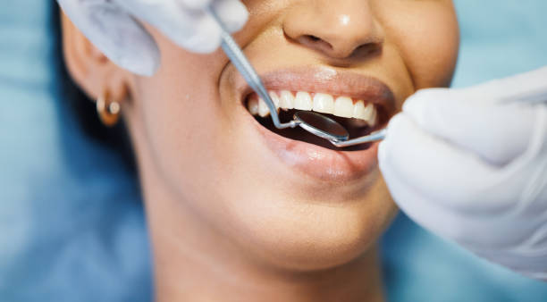 Best Emergency Root Canal Treatment in Hartselle, AL